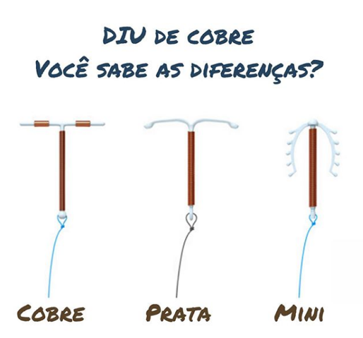 Como escolher o DIU de cobre ideal? – Cinge – Dermatologia, Ginecologia e  Obstetrícia – Águas Claras / Brasília